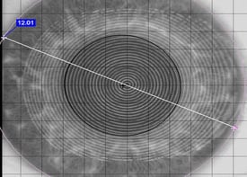 Technique 1: Corneal Topography