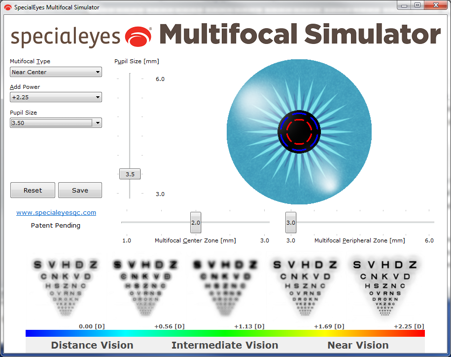 Toric Multifocal Contact Lens Design: Case Study