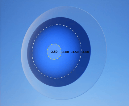 Strategy to fit toric multifocal contact lenses: SpecialEyes 54 Multifocal Design