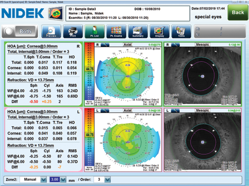 OPD III map used for designing SpecialEyes' lenses