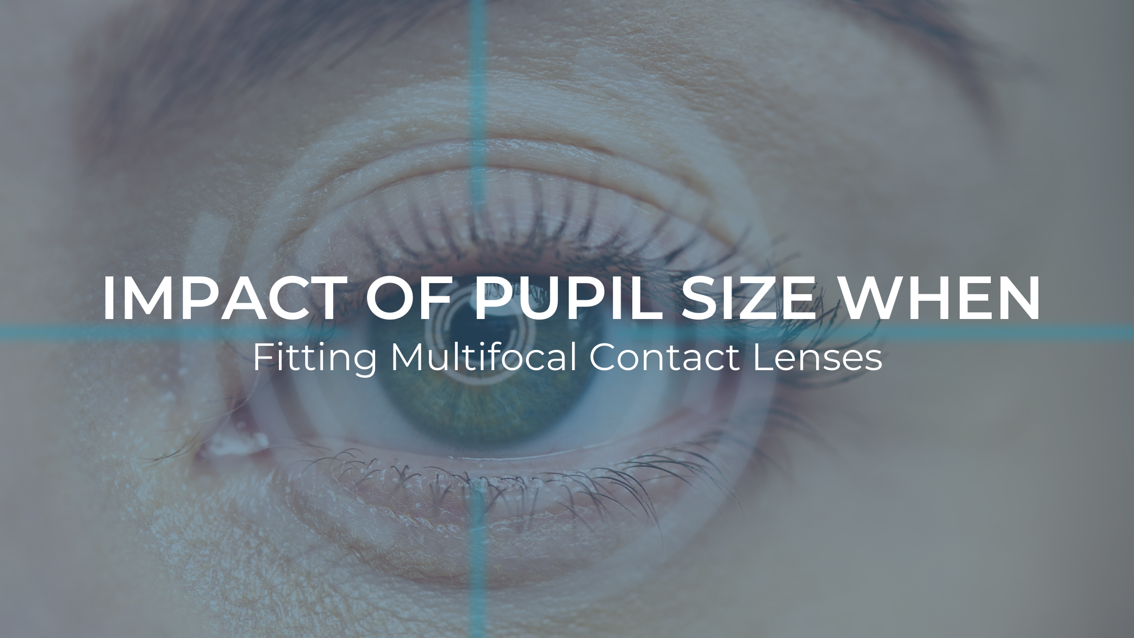 Impact of Pupil Size When Fitting Multifocal Contact Lenses