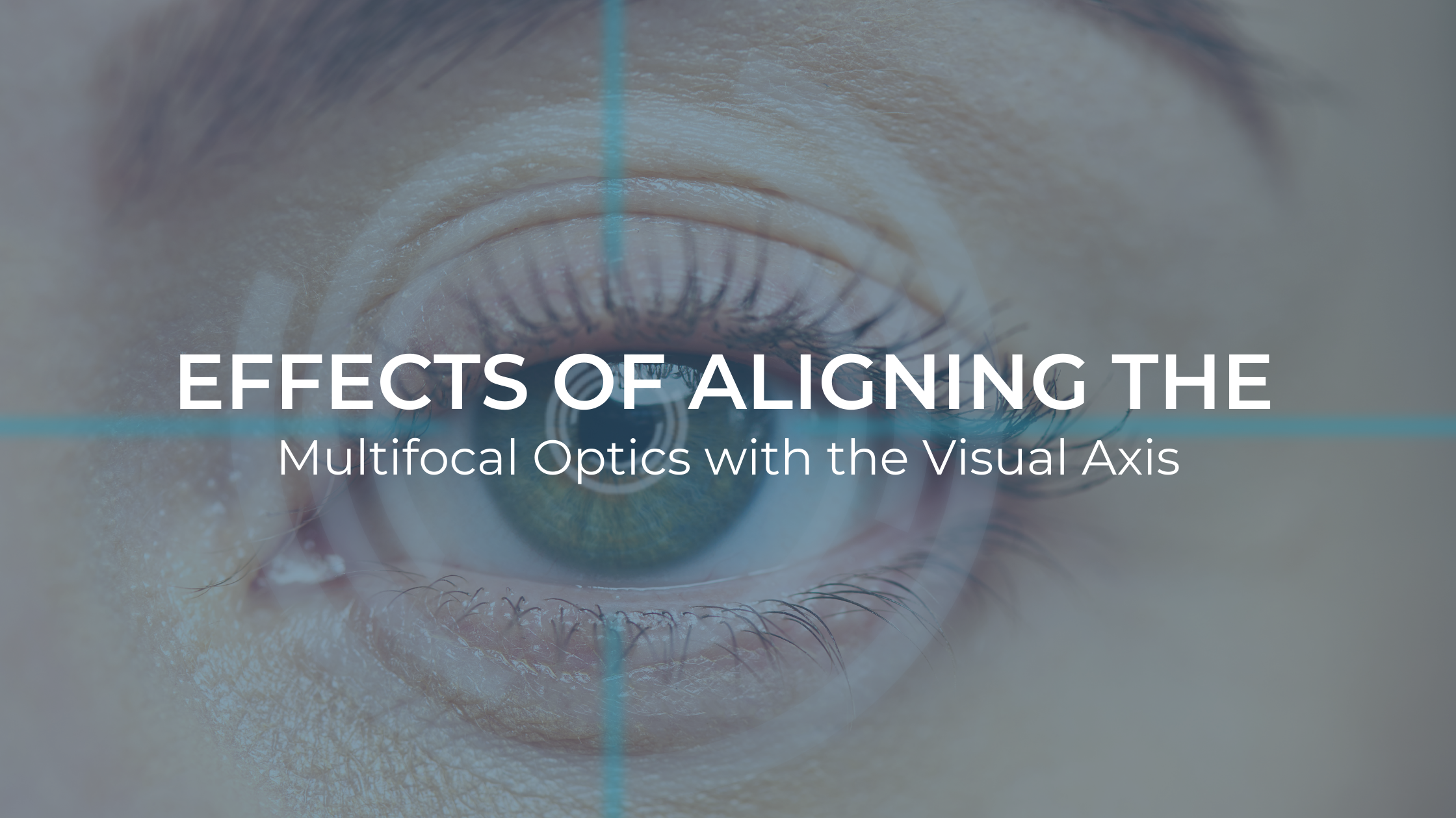 Effects of Aligning the Multifocal Optics with the Visual Axis